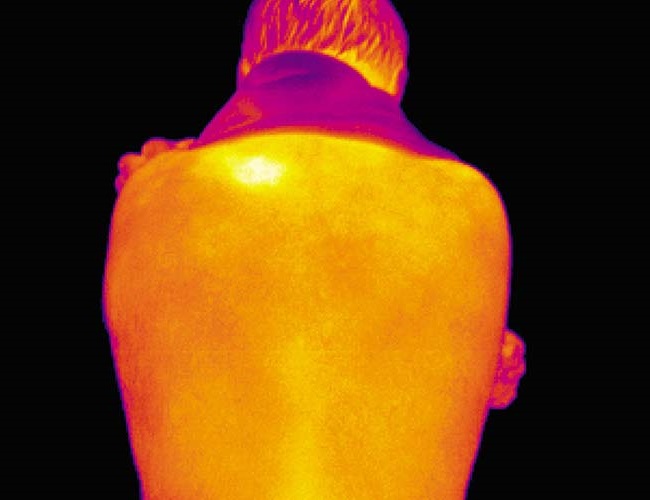 Medical thermography reveals inflammation