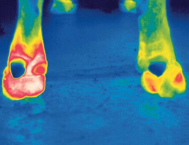 Medical thermography – inflamed body parts are warmer