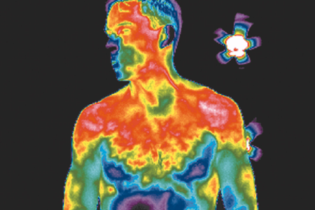 Des caméras infrarouges puissantes servent d’outils de diagnostic ultra-sensibles 